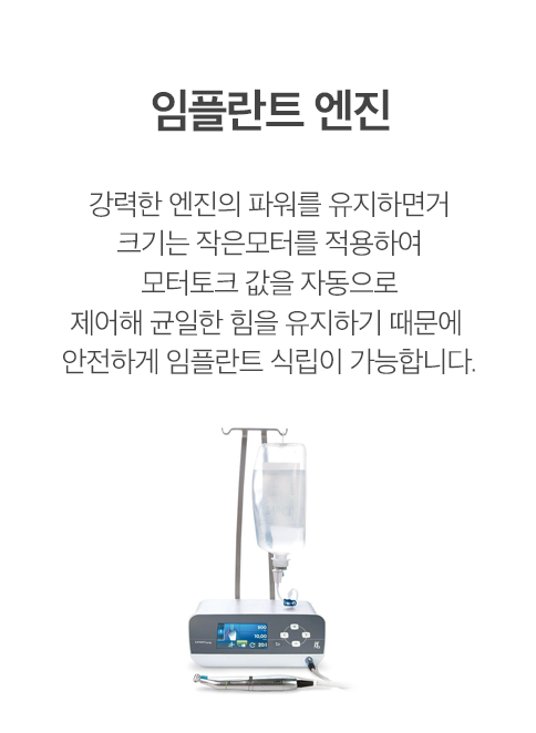 임플란트 엔진